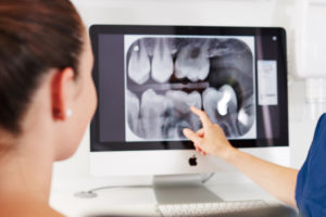 Digitales Röntgen bei Zahnarzt Schophaus nahe Grenzach-Wyhlen